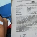 Dua Tahun Mangkrak dan Berbalut Teror: Kasus Penganiayaan Anak di Pandeglang Sorot Kinerja Aparat Penegak Hukum