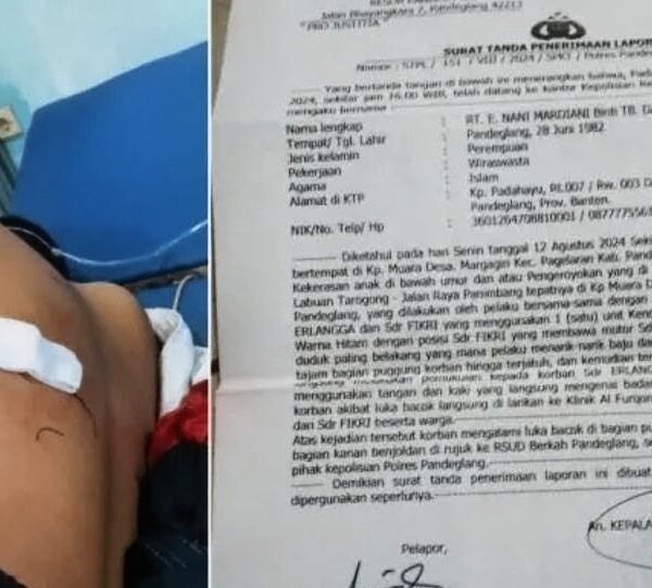 Dua Tahun Mangkrak dan Berbalut Teror: Kasus Penganiayaan Anak di Pandeglang Sorot Kinerja Aparat Penegak Hukum